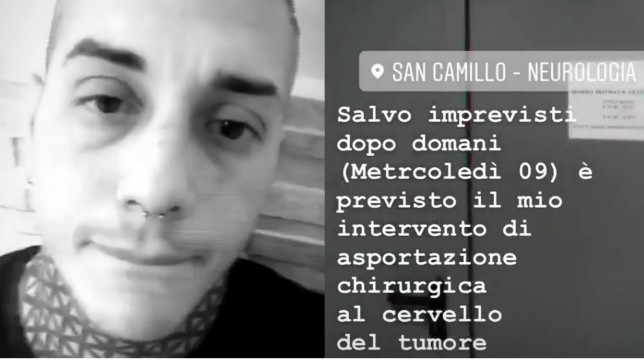 Francesco Chiofalo, domani l'intervento per l'asportazione chirurgica del tumore al cervello