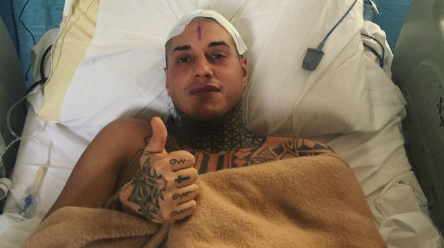 Francesco Chiofalo, operazione: le immagini condivise da Alessio Bruno rassicurano i fan, il video