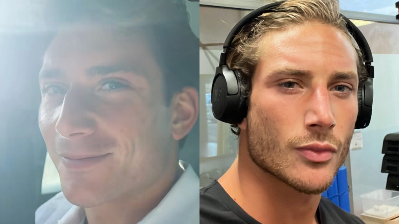 grande fratello tommaso franchi si 232 sottoposto ad alcuni ritocchini estetici interviene maria vittoria minghetti