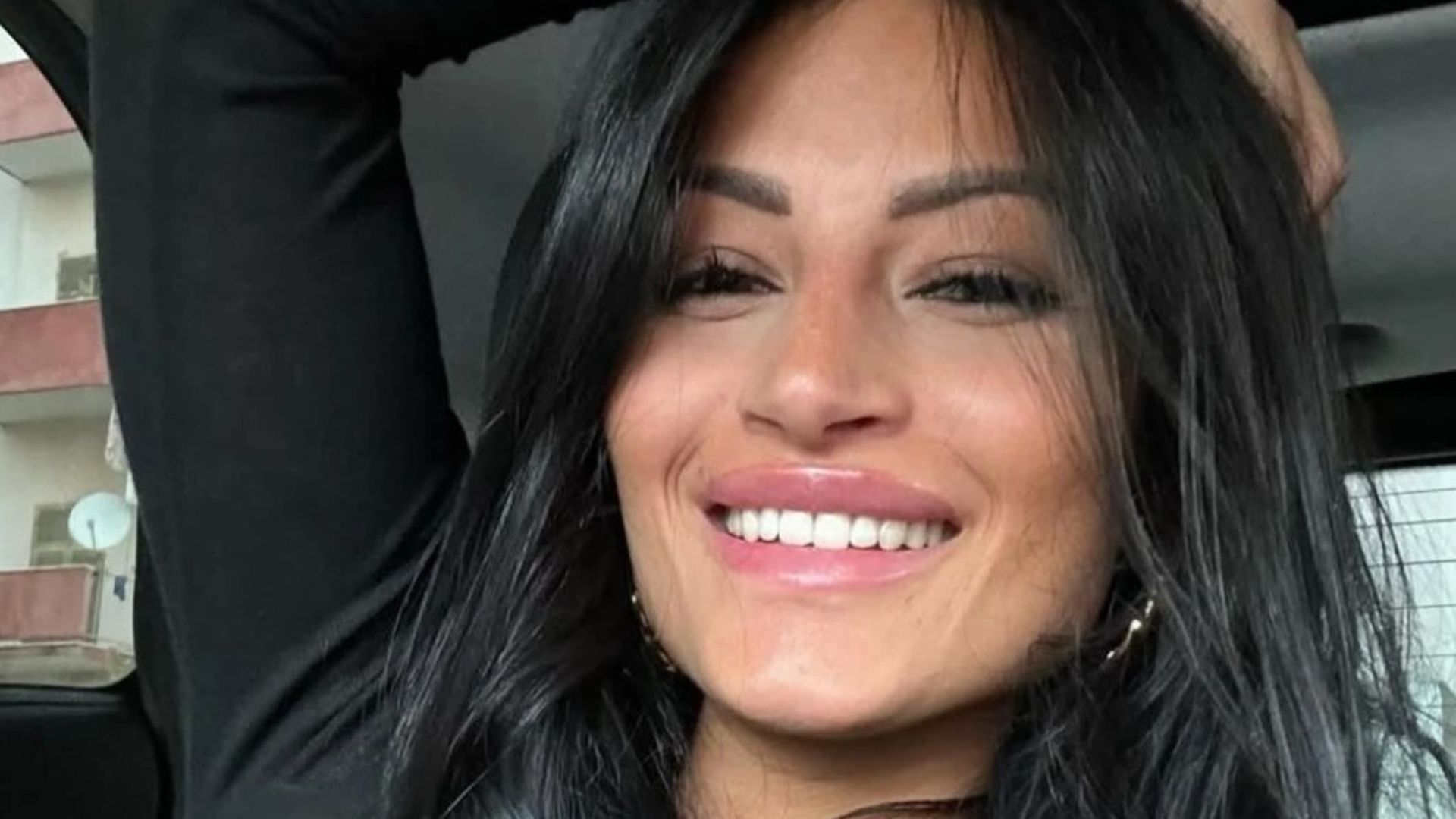 Temptation Island, Alessia Pascarella: "Mi sono ritrovata investita: punto alla testa, lesioni in tutto il corpo" Temptation Island, Alessia Pascarella: "Mi sono ritrovata investita: punto alla testa, lesioni in tutto il corpo"