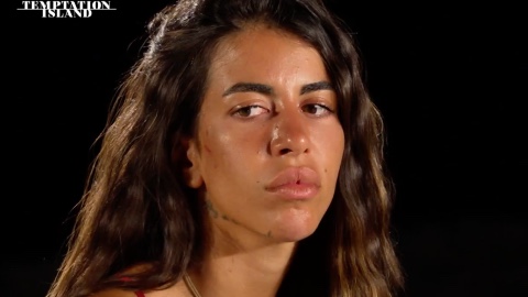 Temptation Island, Alessandra: cosa c’è scritto sul tatuaggio sul mento?