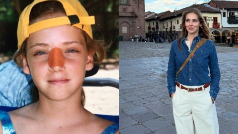 Chiara Ferragni, la verità sul suo naso: "Ecco perché è un po’ storto"
