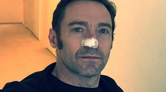 Hugh Jackman, nuova operazione per un tumore alla pelle: "Mettete la crema solare"
