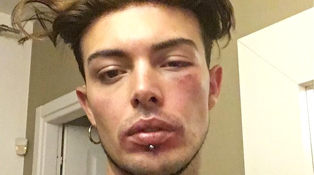 Amici, Stash dei The Kolors: "Quando vedete un'ingiustizia, agite"