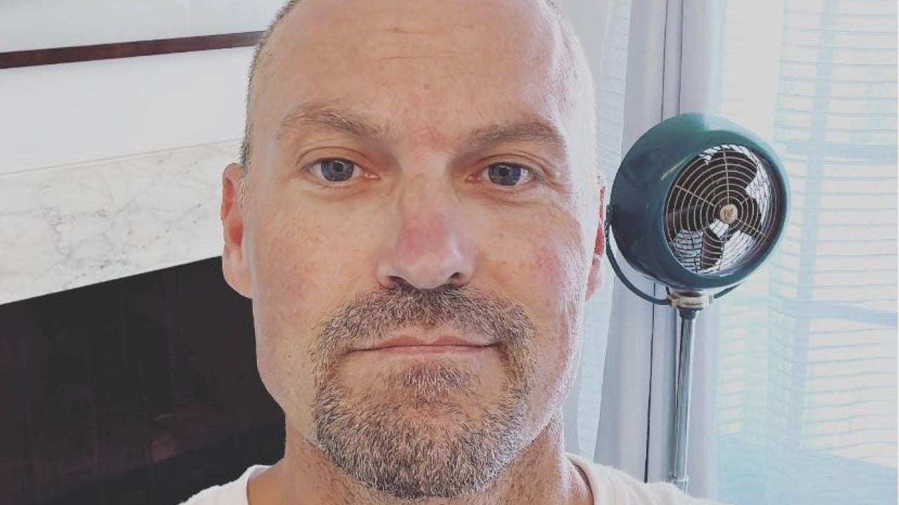 Brian Austin Green ha combattuto per 4 anni con i sintomi di un ictus, ma la