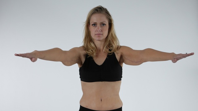 Skin Tight: la mia nuova pelle