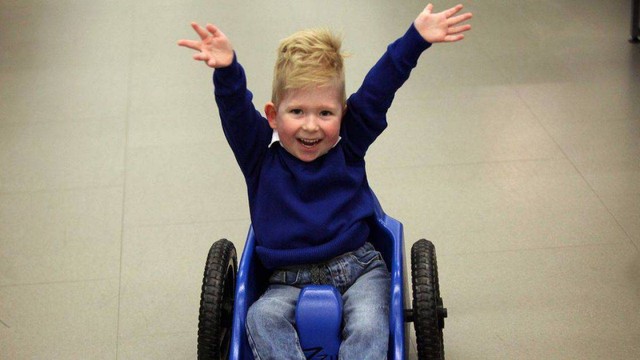 Il bambino nato senza cervello