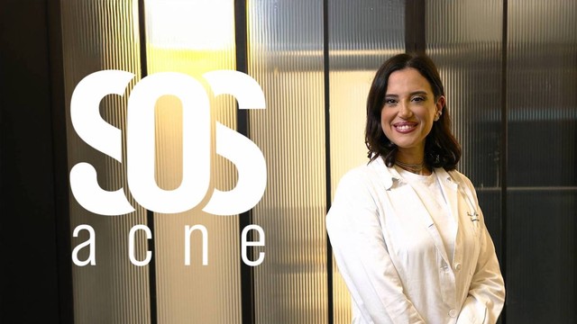 SOS acne